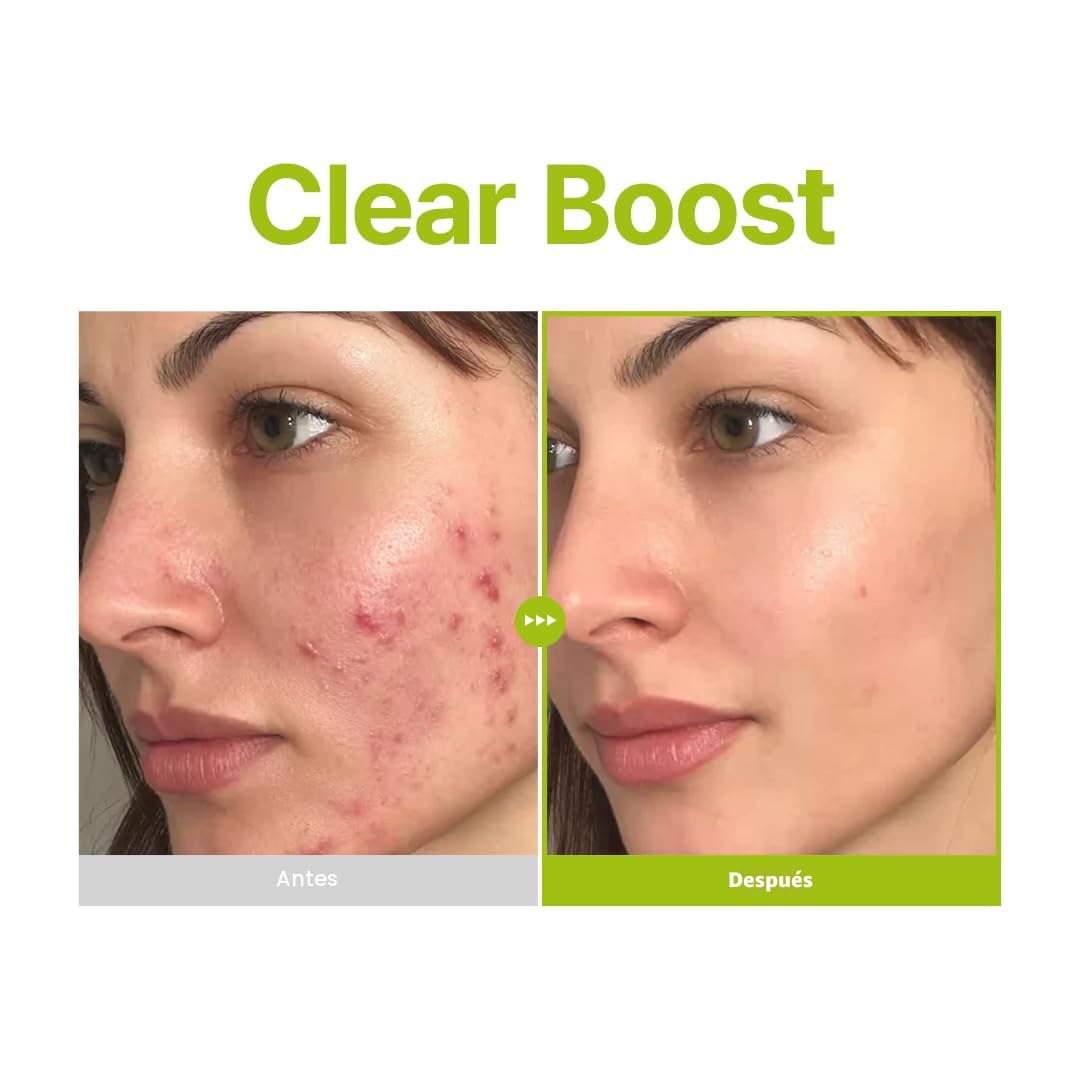 Azelaic Acid 10 Kojic Tea Tree Serum, Purito