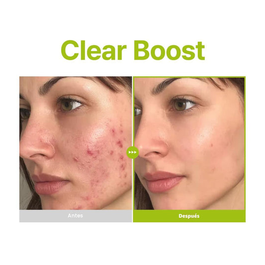 Azelaic Acid 10 Kojic Tea Tree Serum, Purito