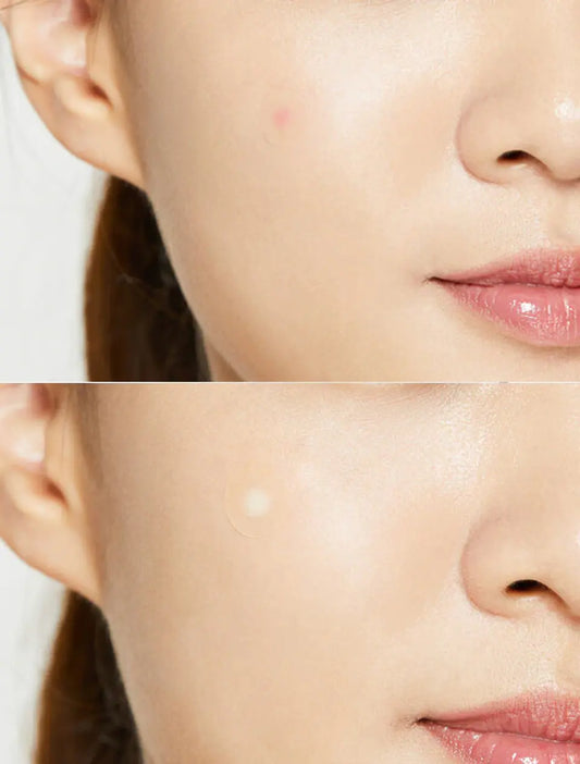 Medi Patch Spot Patch